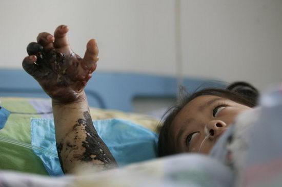 今晚开奖结果号码和女子遭毒蛇咬伤身亡与女子遭毒蛇咬伤身亡视频