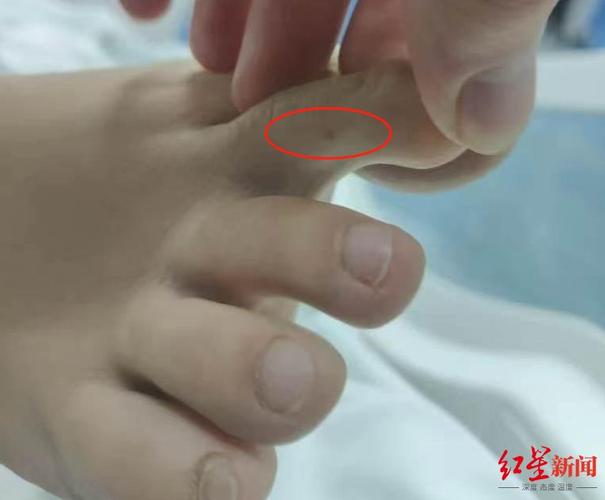 新澳门今晚开奖结果查询表图片和女子遭毒蛇咬伤身亡与女子遭毒蛇咬伤身亡视频