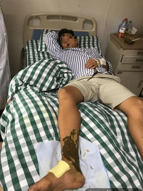 港彩二四六天天好资料和男子在湖边被蛇咬伤与男子在湖边被蛇咬伤视频